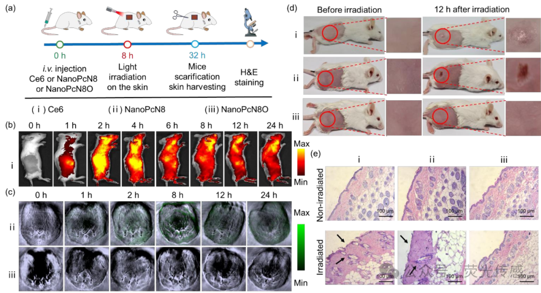 Professor Li Xingshu and Academician Juyoung Yoon in Angew: Hypoxia-triggered Bioreduction of Hydrophilic Type I Photosensitizers for Switchable In Vivo Photoacoustic Imaging and High-specificity Cancer Phototherapy