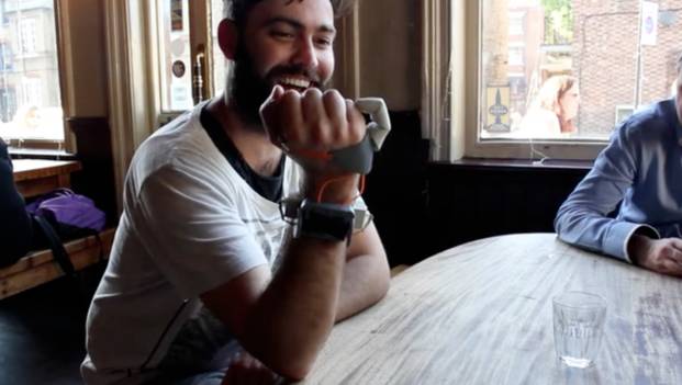 Incredible! 3D Printing a Finger to Transform Ordinary People into Six-Fingered Musicians!?