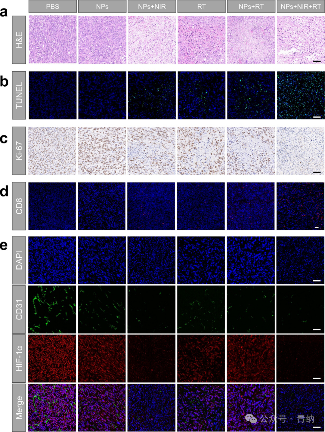 ACS Nano | Organic Radiotherapy Sensitizers with AIE Characteristics Achieve Tumor Ablation through Synergistic Induction of Apoptosis and Immunogenic Cell Death