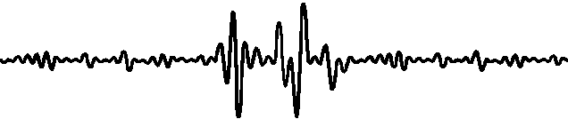 Comparison of Three Major Serial Transmission Buses