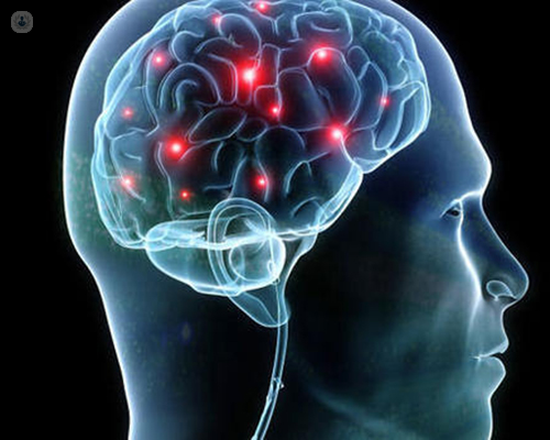 Progression-Free Survival Increased Fivefold, Intracranial Response Rate at 65.7%! 'Miraculous Anti-Cancer Drug' Solves the Treatment Challenge of Breast Cancer Brain Metastases