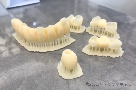 A Comprehensive Analysis of the Advantages and Disadvantages of 3D Printed Dentures: Is the Cost Three Times Higher than Traditional Dentures Justified?