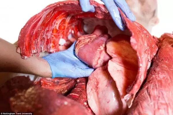 3D Printed Human Models for Surgical Training