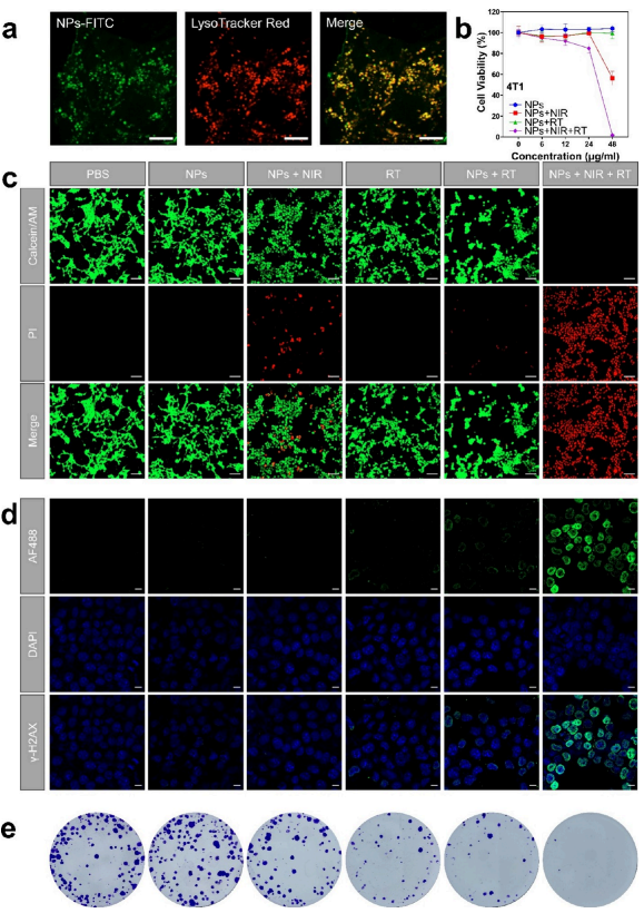 Organic Radiosensitizer with Aggregation-Induced Emission Characteristics for Tumor Ablation through Synergistic Apoptosis and Immunogenic Cell Death