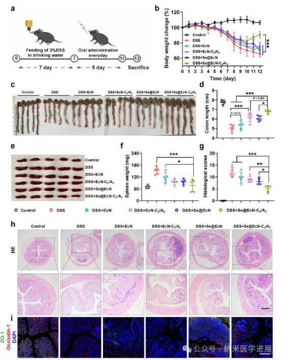 Triple-Functional Probiotics with Intracellularly Synthesized Selenium Nanoparticles for Colitis Therapy by Regulating the Macrophage Phenotype and Modulating Gut Microbiota