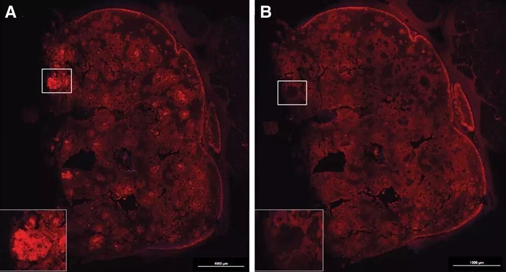 Successful 3D Printing of Cartilage Tissue Brings Humanity Closer to Immortality!
