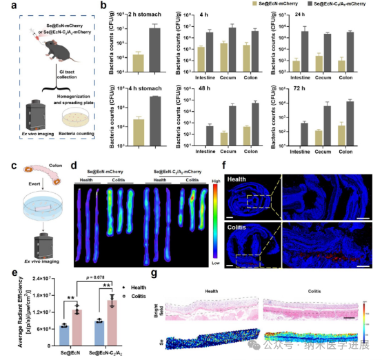 Triple-Functional Probiotics with Intracellularly Synthesized Selenium Nanoparticles for Colitis Therapy by Regulating the Macrophage Phenotype and Modulating Gut Microbiota