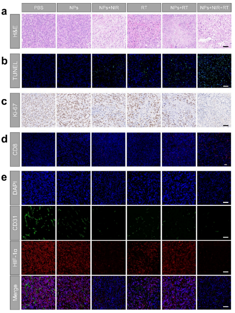 Organic Radiosensitizer with Aggregation-Induced Emission Characteristics for Tumor Ablation through Synergistic Apoptosis and Immunogenic Cell Death