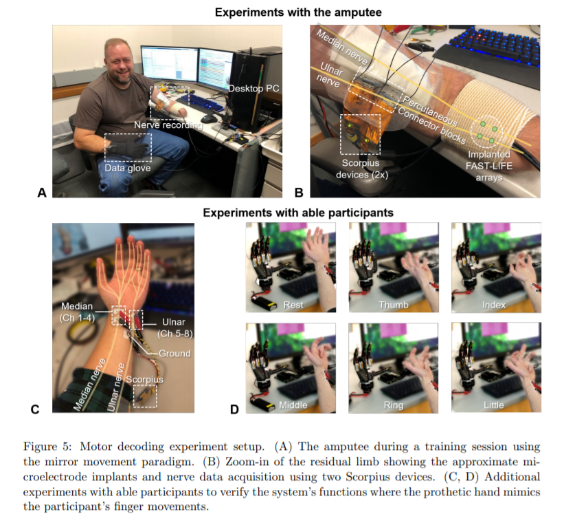How Can Development Boards Be Used? American Scholars Use Jetson Nano to Support Portable AI Prosthetics, Controlling Each Finger