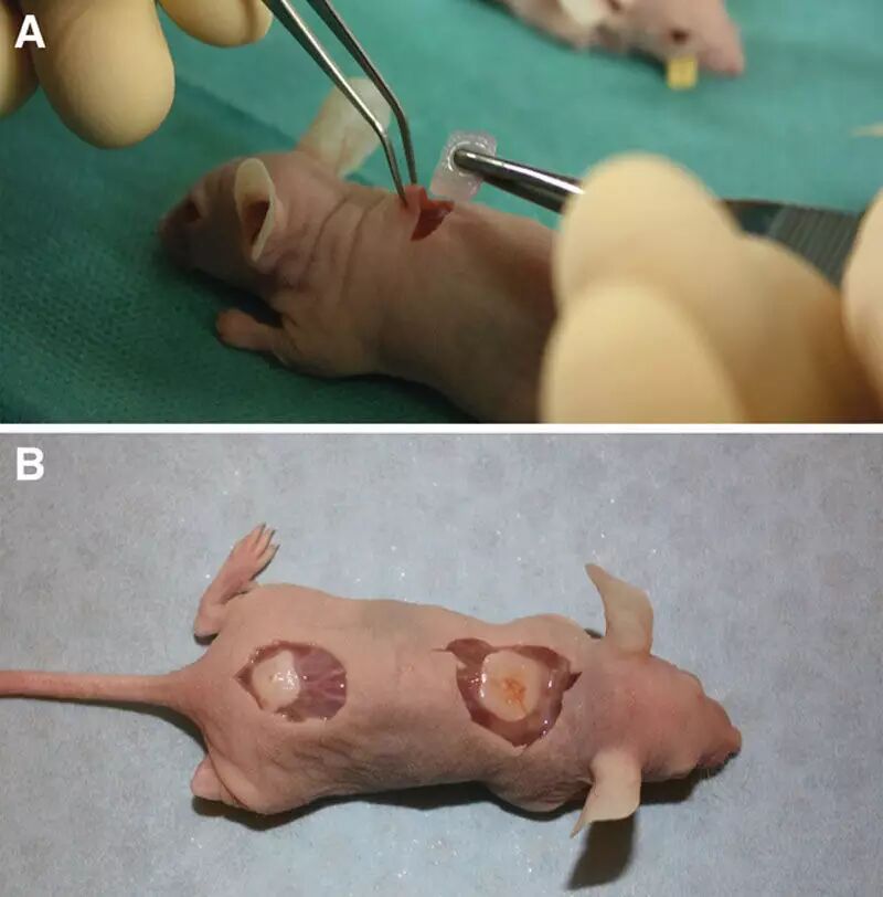 Successful 3D Printing of Cartilage Tissue Brings Humanity Closer to Immortality!
