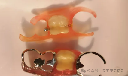 A Comprehensive Analysis of the Advantages and Disadvantages of 3D Printed Dentures: Is the Cost Three Times Higher than Traditional Dentures Justified?