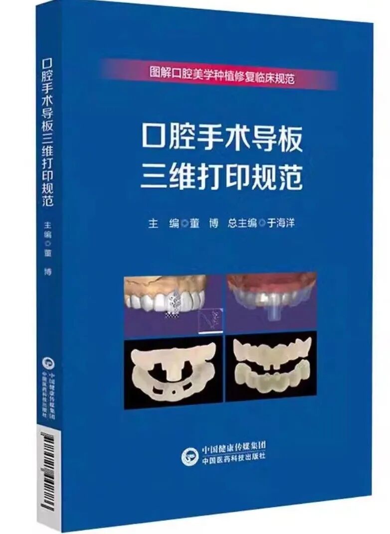 Application of 3D Printing in Digital Implant Surgical Guides