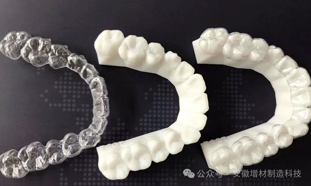 3D Printing Technology: Reshaping the Precision and Personalization of Dental Care
