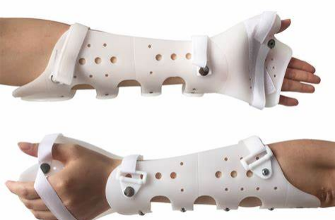 How 3D Printing Technology is Revolutionizing Rehabilitation Braces