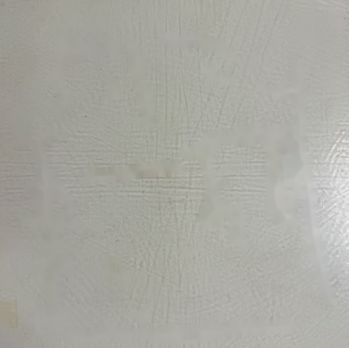 3D Printing! Customized Shields for Breast Cancer Patients Undergoing Radiotherapy