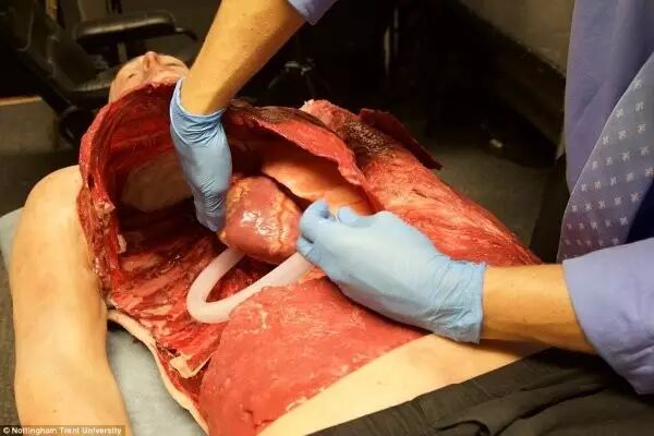3D Printed Human Models for Surgical Training