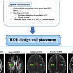 Evaluation of the Lymphatic System Function Using Diffusion Tensor Imaging Analysis Along the Perivascular Space (DTI-ALPS): A Cross-Vendor Test-Retest Validation