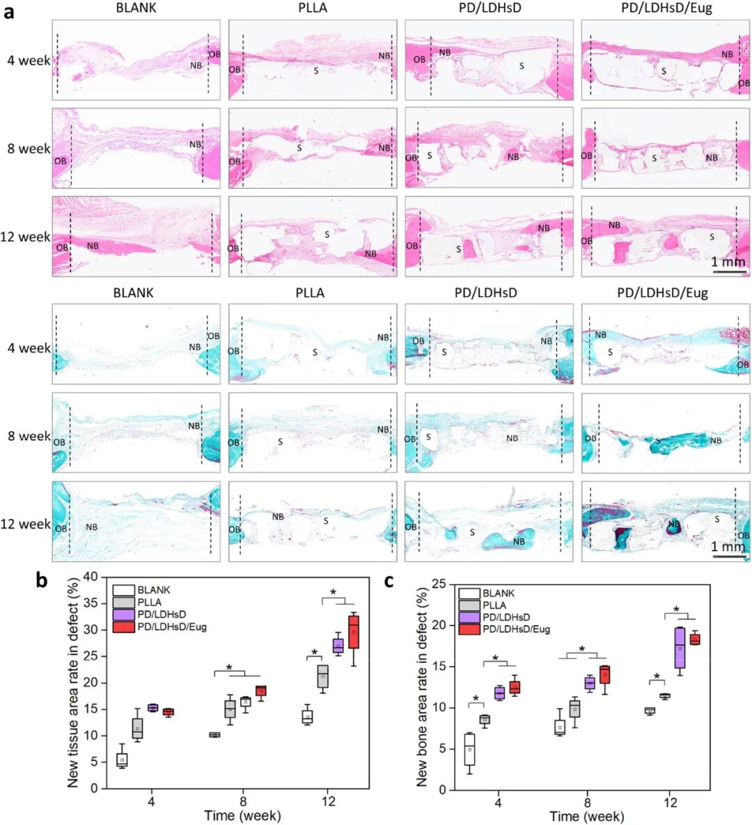 Professor Luo Binghong's Team from Jinan University Publishes in ACS Nano: A Multifunctional 3D Printed Scaffold with Spatiotemporal Release of Multiple Drugs for Bone Regeneration