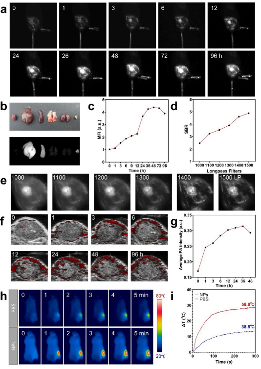 Organic Radiosensitizer with Aggregation-Induced Emission Characteristics for Tumor Ablation through Synergistic Apoptosis and Immunogenic Cell Death