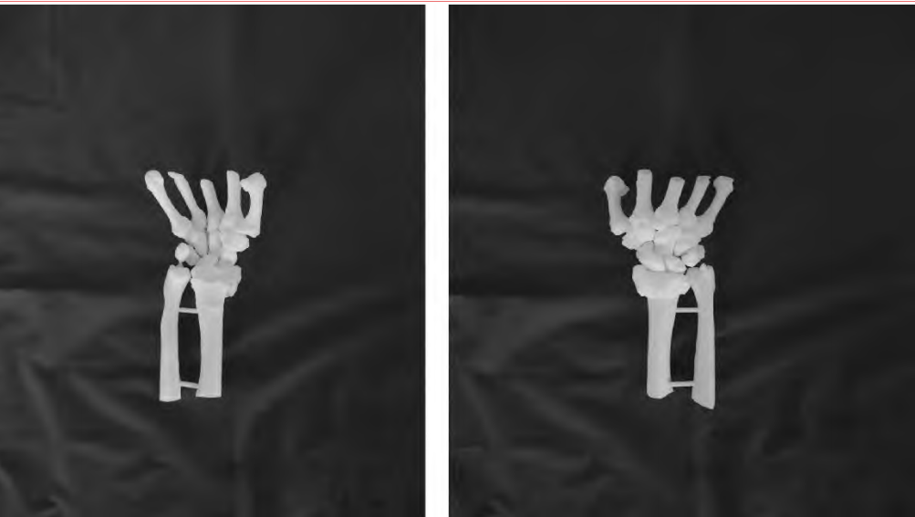 Application of 3D Printing Technology in Orthopedics