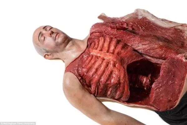 3D Printed Human Models for Surgical Training