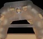 Application of 3D Printing in Digital Implant Surgical Guides