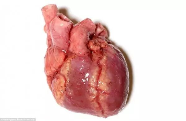 3D Printed Human Models for Surgical Training