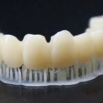 3D Printing Technology: Reshaping the Precision and Personalization of Dental Care
