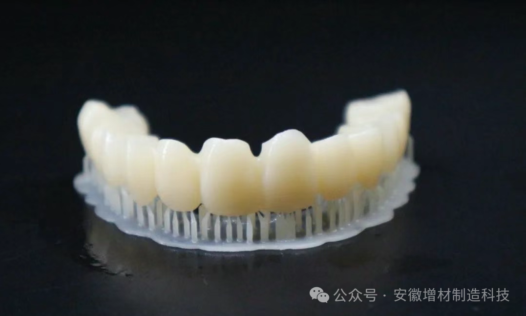 3D Printing Technology: Reshaping the Precision and Personalization of Dental Care