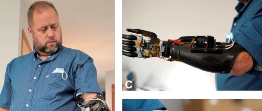 How Can Development Boards Be Used? American Scholars Use Jetson Nano to Support Portable AI Prosthetics, Controlling Each Finger