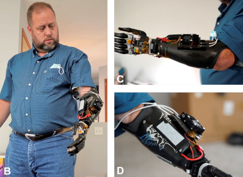 How Can Development Boards Be Used? American Scholars Use Jetson Nano to Support Portable AI Prosthetics, Controlling Each Finger