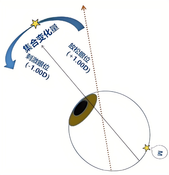The Relationship Between Accommodation and Convergence: CA/C and AC/A and Their Examination Methods