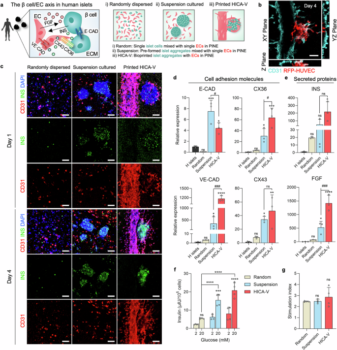 3D Printing of Islets: Can Printed Islets Treat Diabetes? Research Shows That Constructing Islet-Specific Microenvironments Through Bioprinting Technology Can Enhance Insulin Secretion!