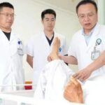 3D Printed Custom Prosthetics: Yantai Doctors Become 'Designers' to Reconstruct Patients' Sternums