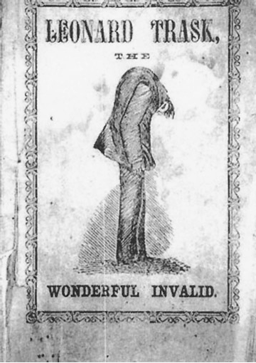 The History of Ankylosing Spondylitis/Axial Spondyloarthritis – What Drives New Knowledge?