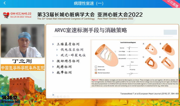GW-ICC Report | Ventricular Arrhythmia Forum: Overcoming Challenges in Electrophysiological Technology