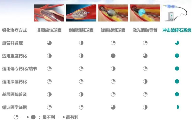 Intravascular Shockwave Balloon Catheter: Key Shockwave Patent Invalidated, Is a Spring for Domestic Devices Approaching?