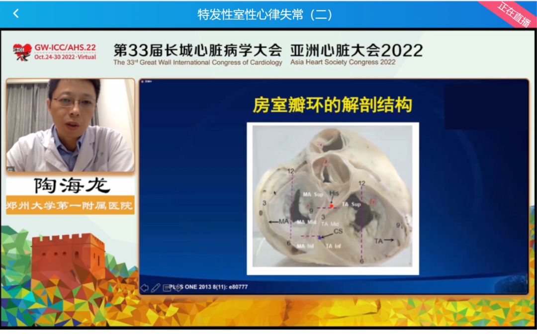 GW-ICC Report | Ventricular Arrhythmia Forum: Overcoming Challenges in Electrophysiological Technology