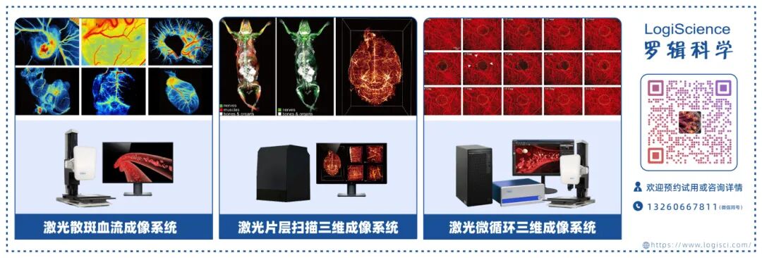 Nature Sub-Journal: Photoacoustic Imaging Technology for Precise Visualization of Tumor Microenvironments
