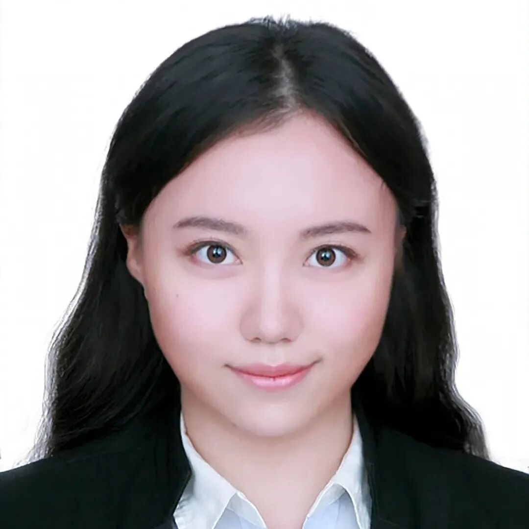 A Novel 3D Printed Antibiotic-Loaded Intraocular Lens: A Breakthrough for Post-Cataract Endophthalmitis Patients!