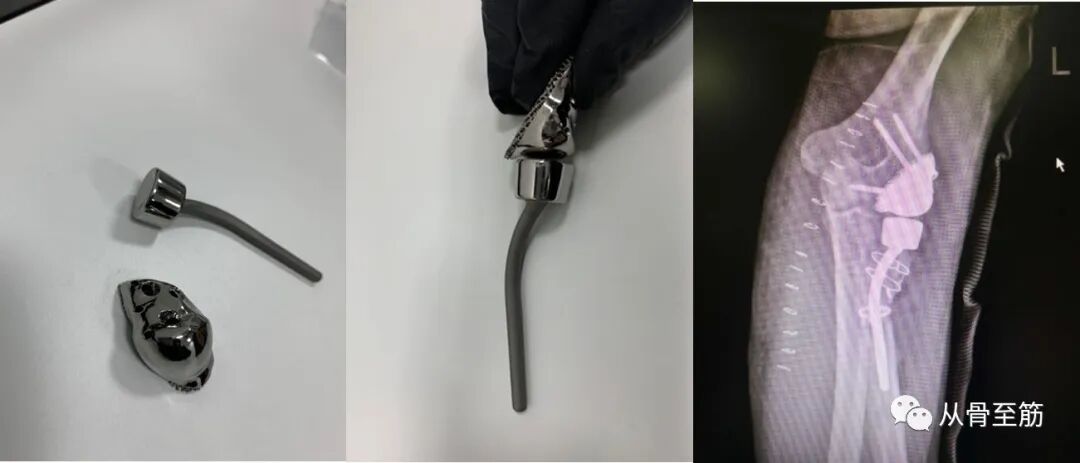 Applications of 3D Printing Technology in Orthopedics