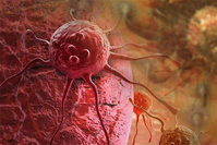 Cutting-Edge Collaboration: Southern Airlines and Montreal Research Team Launch DFN-D System Driven by Piezoelectric Robots for MRI Imaging, Aiming to Address MRI Treatment Challenges!