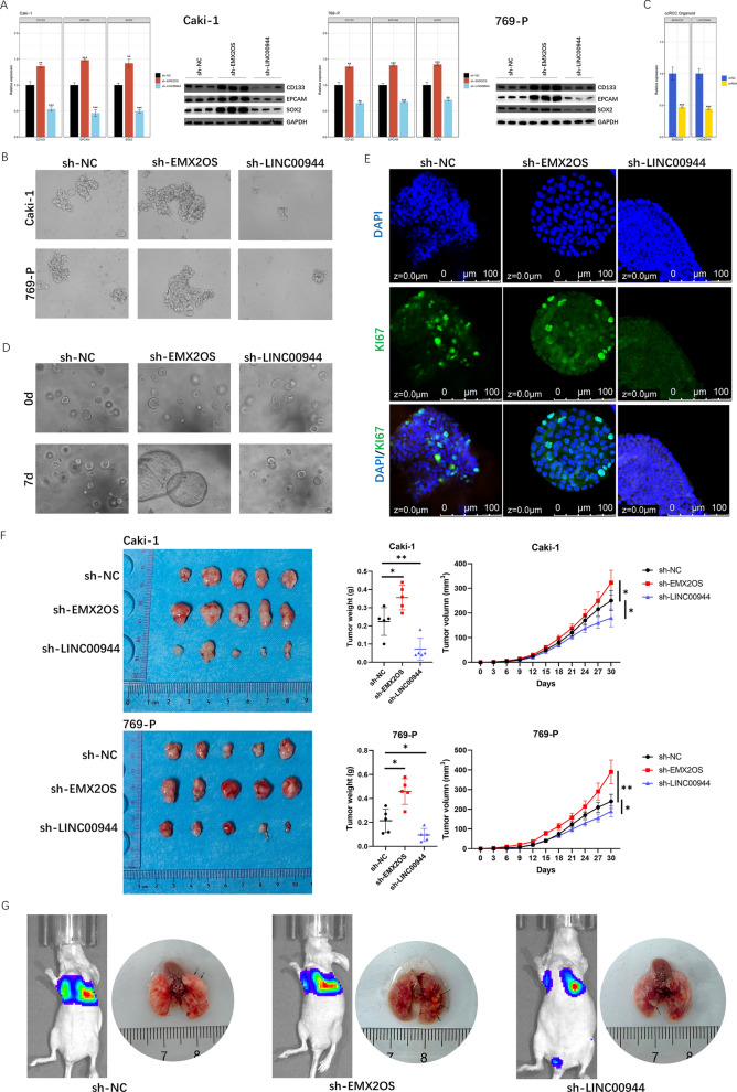 A Novel Stemness-Related lncRNA Signature Predicts Prognosis, Immune Infiltration, and Drug Sensitivity in Clear Cell Renal Cell Carcinoma
