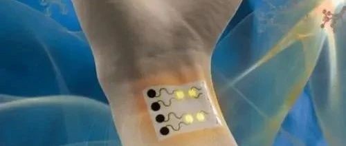 Industry Research on Biosensors