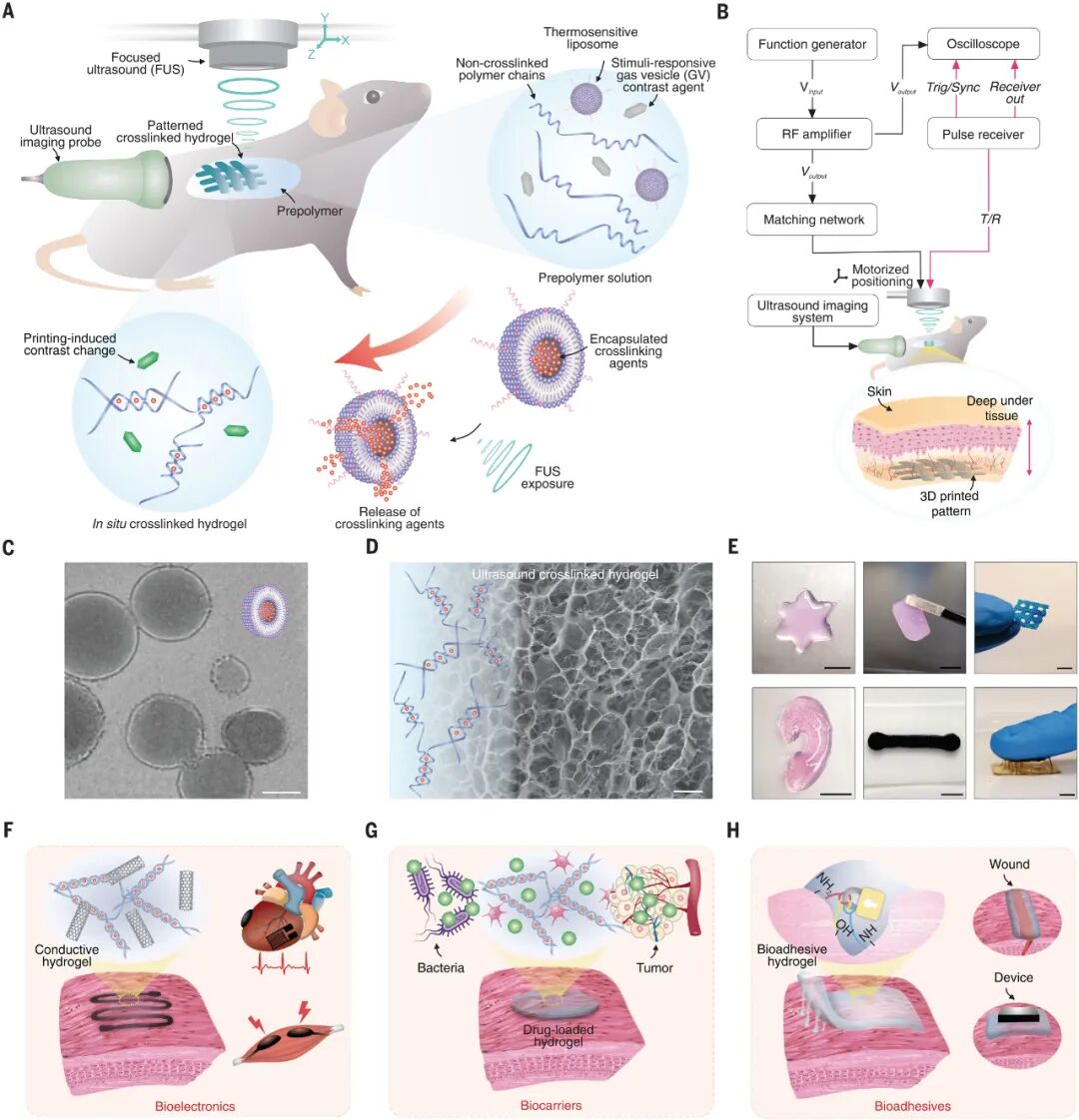 Ultrasound 3D Printing Enables Non-Invasive Surgery! Research Shows: Ultrasound-Guided In Vivo Acoustic Printing Technology Achieves High-Resolution Biological Structure Printing!