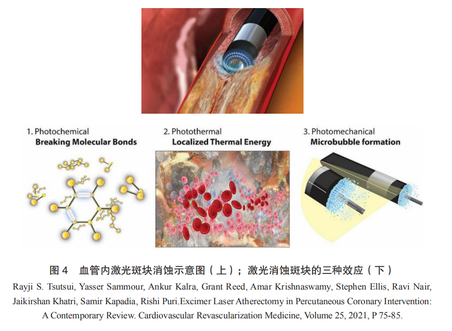 Cardiac Pacemakers and Ablation Devices
