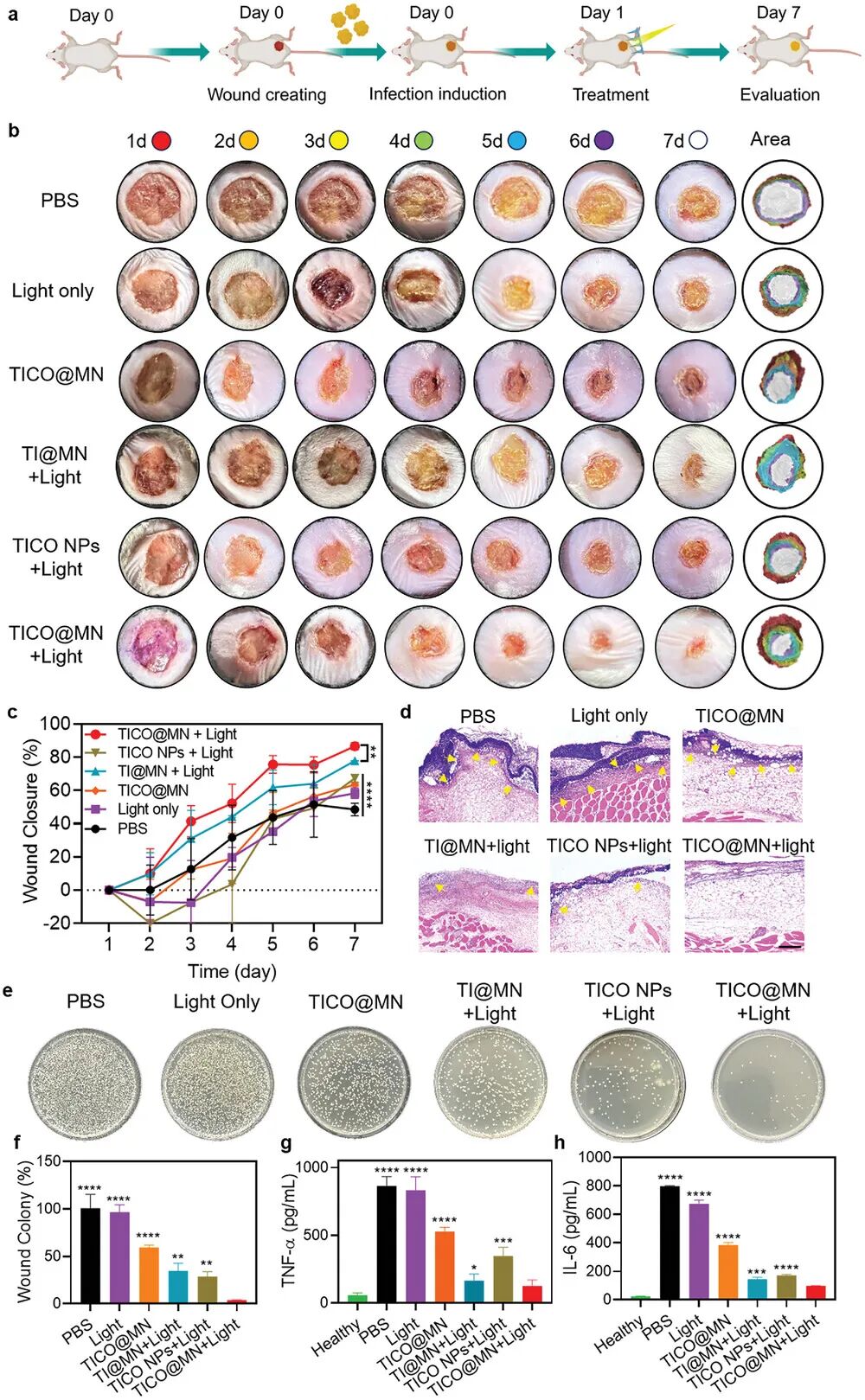 Bacterial Microenvironment-Responsive Microneedle Patches for Real-Time Monitoring and Synergistic Eradication of Infection