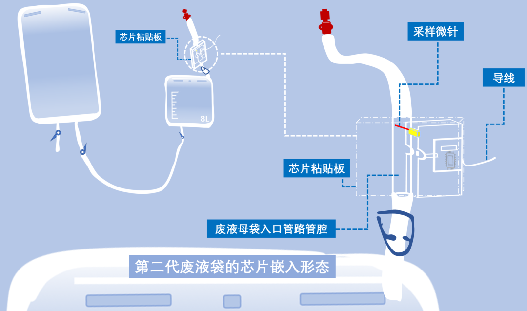 Professor Zhang Ling: Advances and Breakthroughs in Severe Blood Purification Technology