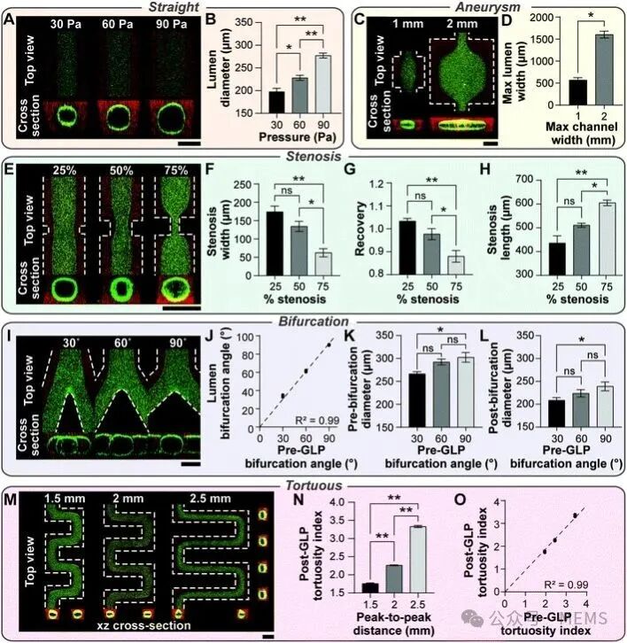 Customized Vascular Chips Simulating Real Vascular Structures to Aid Vascular Disease Research