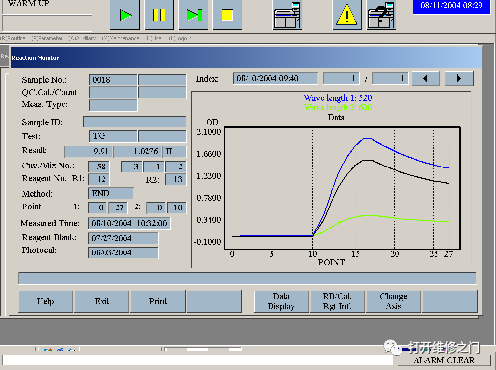 Analysis of the 'Prozone Effect' in AU Biochemical Analyzers